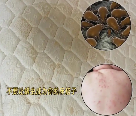 螨蟲